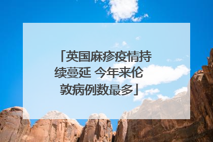 英国麻疹疫情持续蔓延 今年来伦敦病例数最多